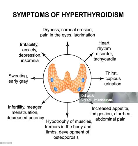 hyperthyreoïdie symptomen