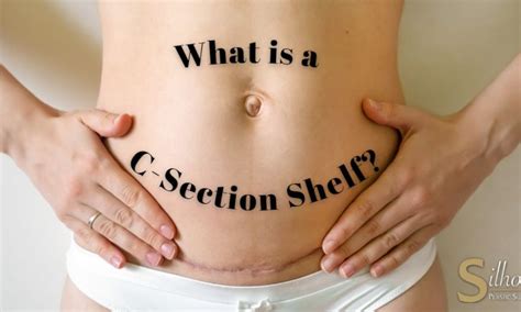 i after work  existerar a c section