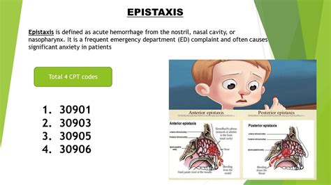 Icd 10 Code For Epistaxis