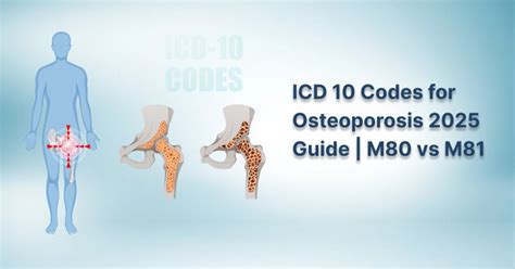 Icd 10 Code For Osteoporosis