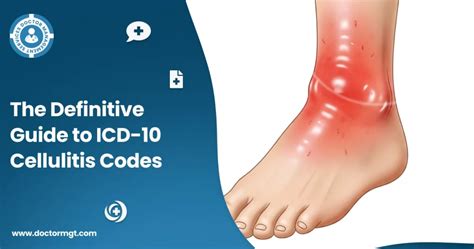 Icd Code 10 Cellulitis