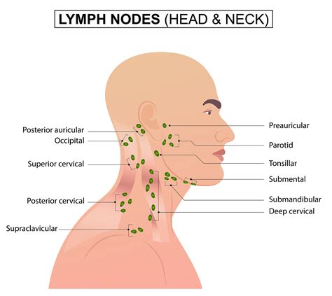 Icd10 Neck Lymph Nodes