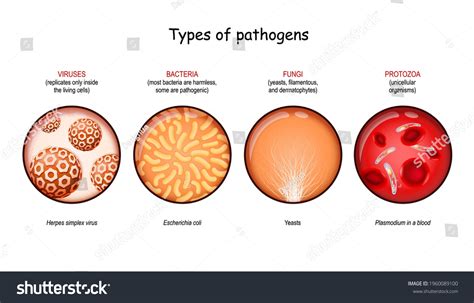 identification of pathogenic f