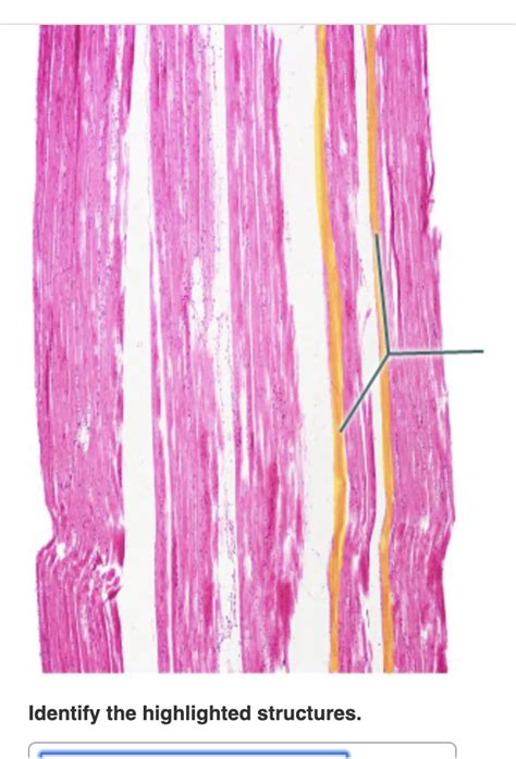 Identify The Highlighted Structure