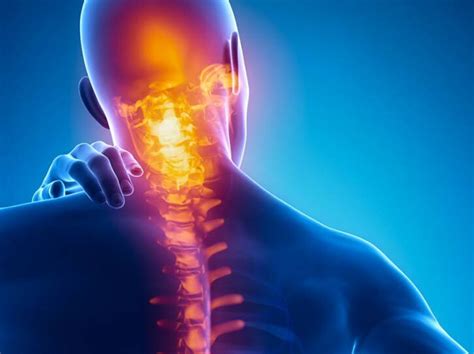 Il Dolore Cervicale