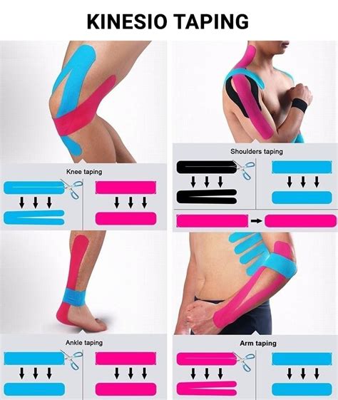 illustrated kinesio taping