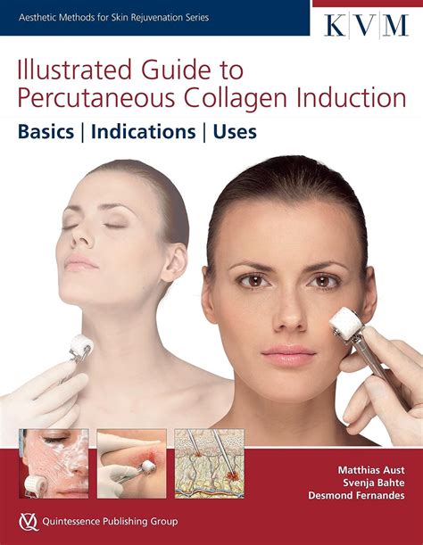 Download Illustrated Guide To Percutaneous Collagen Induction Basics Indications Uses Aesthetic Methods For Skin Rejuvenation 