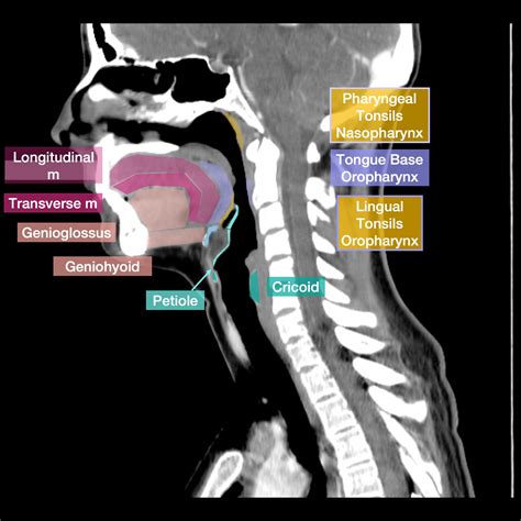 images.radiopaedia.org