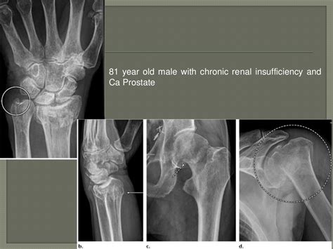Download Imaging Of Arthritis And Metabolic Bone Disease Gabaco 