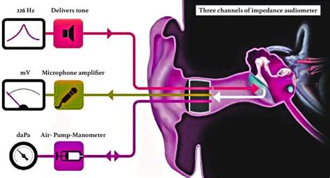 Impedance Audiometry Test