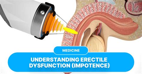impotence | Impotence Alasan Perceraian vs Ketahanan Pernikahan Riset