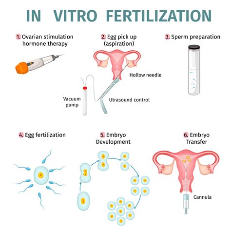 In Vitro Fertilization Library Of Congress