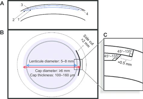 incision geometry and ranges for surgical parameters. Notes incision