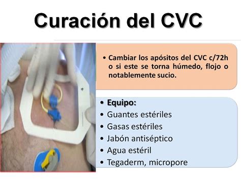 infeccion de catheter venoso central pdf