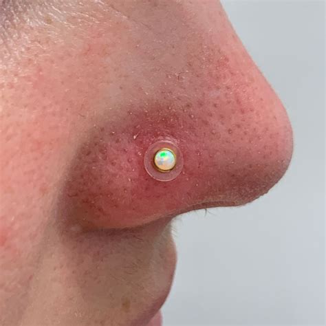 infekterad piercing bula