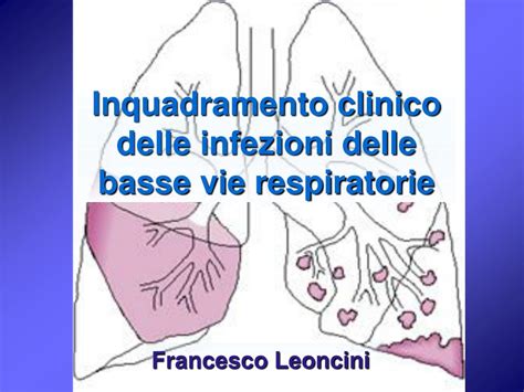 Download Infezioni Delle Basse Vie Respiratorie Lrti Aspetti 