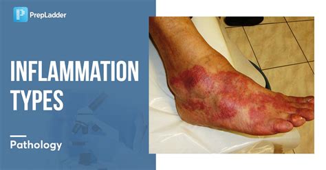 inflammation underben