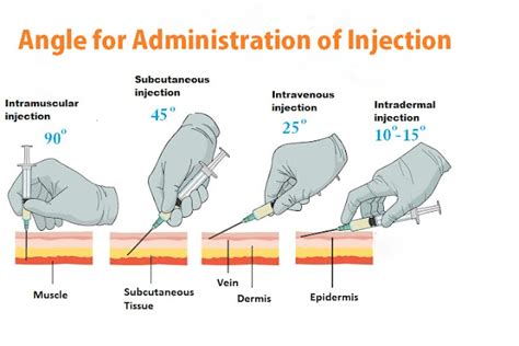 INJECT ID - SQL Injection