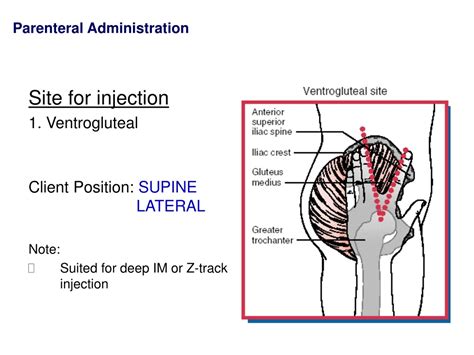 Injection Site Ventrogluteal