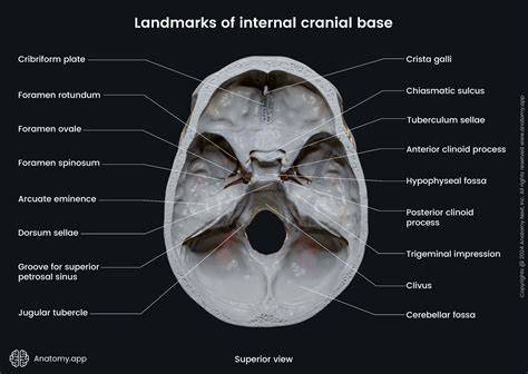 Inside The Skull Of A Spirited Horse