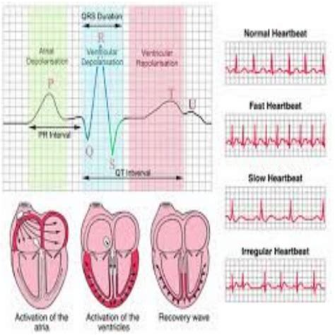 Interpretation Of Basic And Advanced Urodynamics