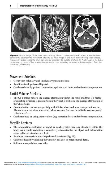 interpretation of emergency head ct a practical h