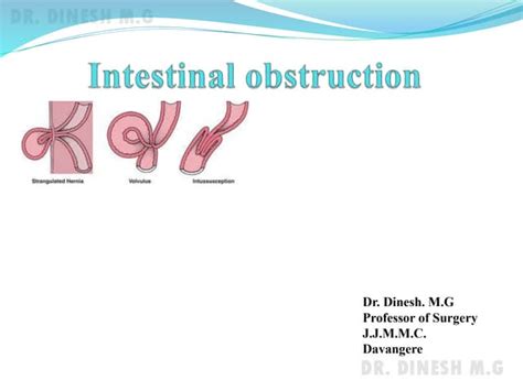 Intestinal Obstruction Ppt