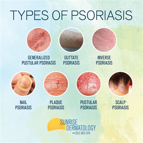 invärtes psoriasis symptom