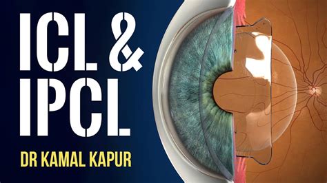 Ipcl Full Form