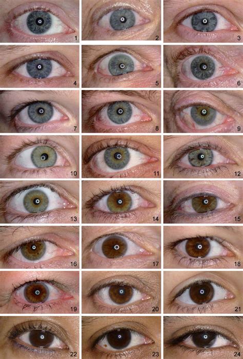 iris color