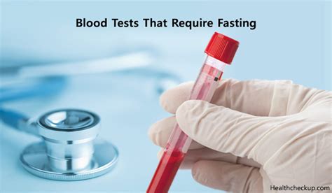 is kissing allowed while fasting blood test free