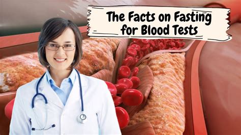 is kissing allowed while fasting blood tests blood