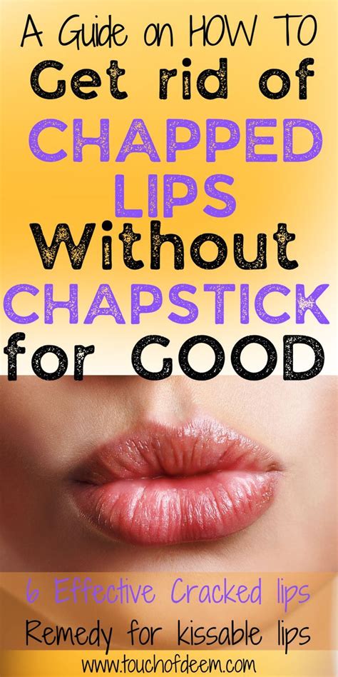 is kissing good for chapped lips without itching