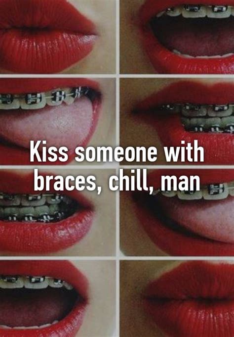 is kissing with braces weird game