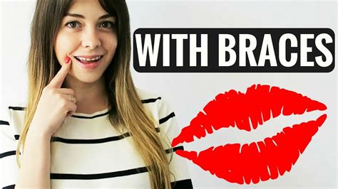is kissing with braces weird videos full episodes