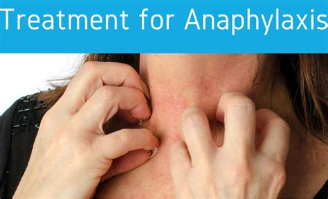 is lip swelling a sign of anaphylaxis blood