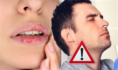 is lip swelling a sign of anaphylaxis coronavirus