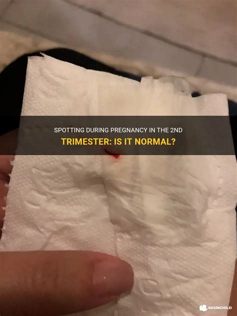 is spotting normal in second trimester
