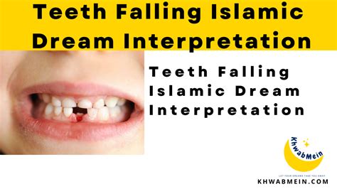 islamic dreams teeth falling out