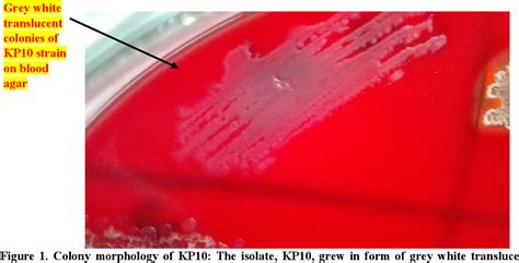 Read Isolation And Identification Of A Catalase Producing 