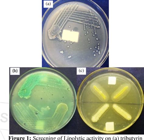 Read Isolation Of Lipase Producing Bacteria And Determination 