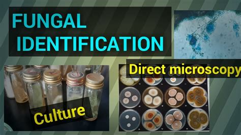 Download Isolation Screening And Identification Of Fungal 