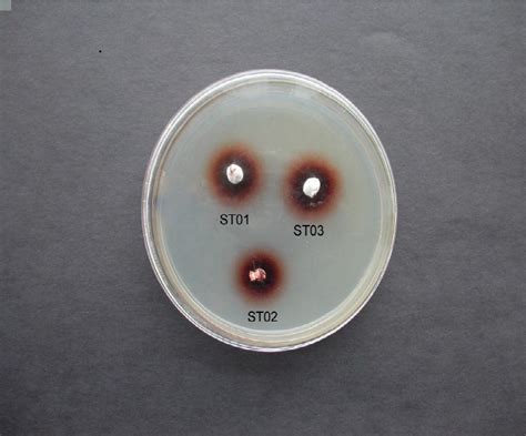 Download Isolation Screening And Identification Of Fungal 