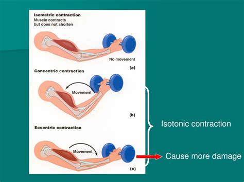 isotonic contraction definition