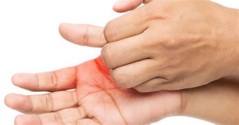 Itchy Right Palm