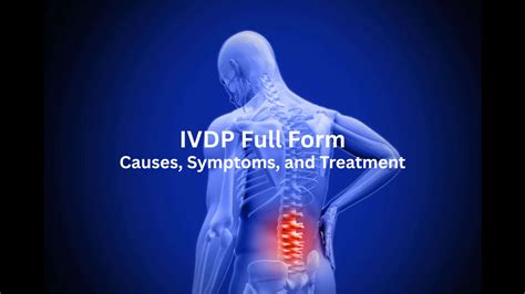 Ivdp Full Form