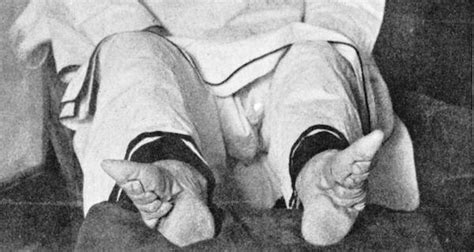 Japanese Foot Binding