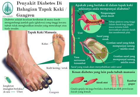 JARI KAKI HITAM DIABETES：Panduan Gejala dan Pengobatan Diabetes Menurut Dokter yang Wajib