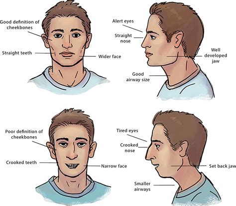 Jaws Book Face Structure