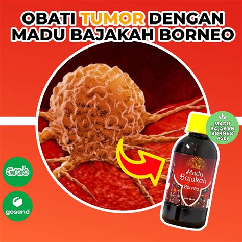 Jual Madu Bajakah Borneo Atasi Tumor Kanker Stroke Madu Bajakah Borneo Adalah - Madu Bajakah Borneo Adalah